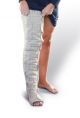 Mobiderm nighttime compression full leg sleeve for leg lymphedema