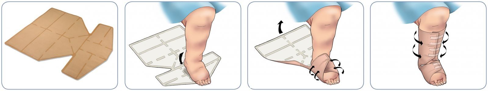 Step by step instructions on the use of the Eclypse Boot Superabsorbent Dressing